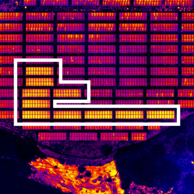 ストリング異常